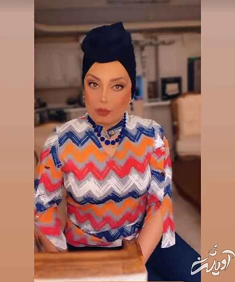 چهره شوک آور صبا راد قبل جلفی و جوگیری ! - تغییر 180 درجه ای خانم مجری !